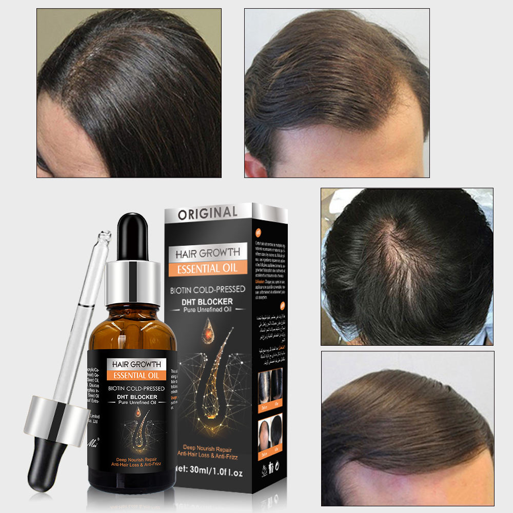 Hair Growth Oil