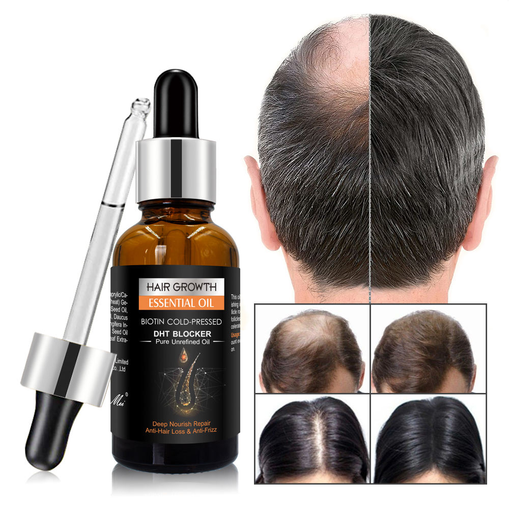 Hair Growth Oil