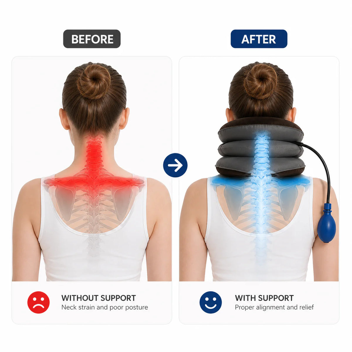 Cervical Neck Traction Device