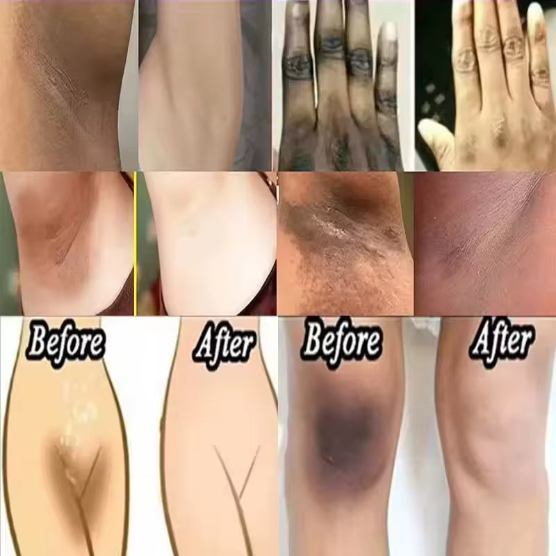 Whitening Cream for Private Parts – Brighten & Even Skin Tone Naturally