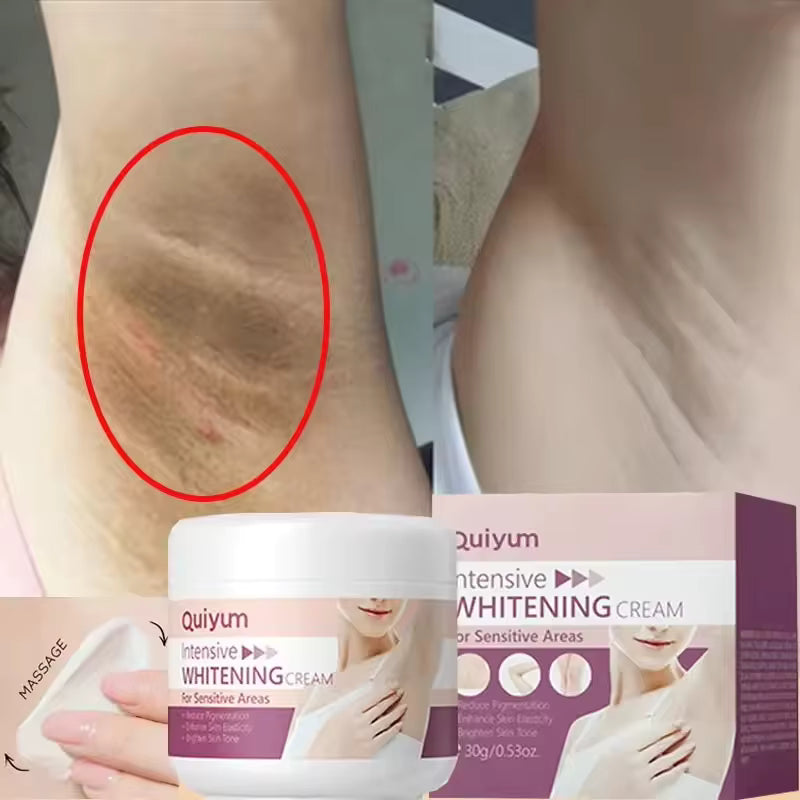 Whitening Cream for Private Parts – Brighten & Even Skin Tone Naturally