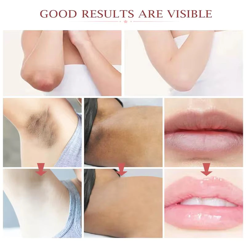 Whitening Cream for Private Parts – Brighten & Even Skin Tone Naturally