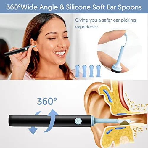 Smart Visual Ear Wax Cleaning Kit with Camera HD