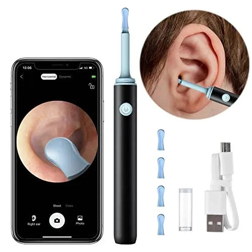 Smart Visual Ear Wax Cleaning Kit with Camera HD